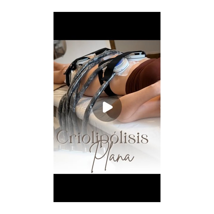 Criolipólisis plana