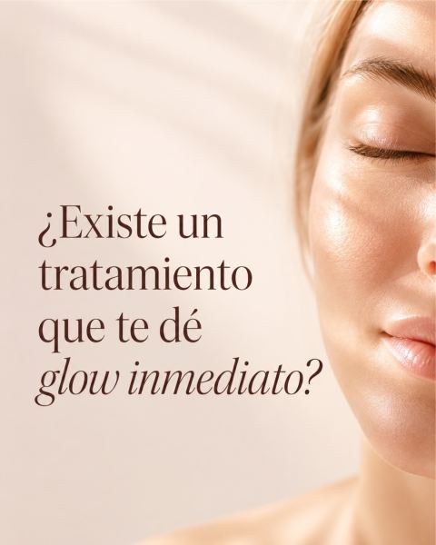Carbon Peel con láser Alma Q