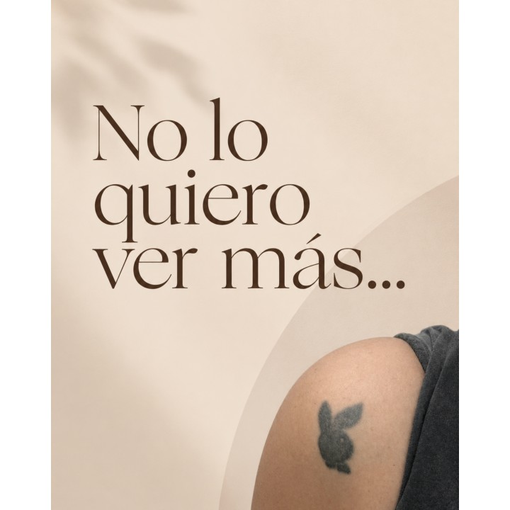 Remoción láser de tatuajes