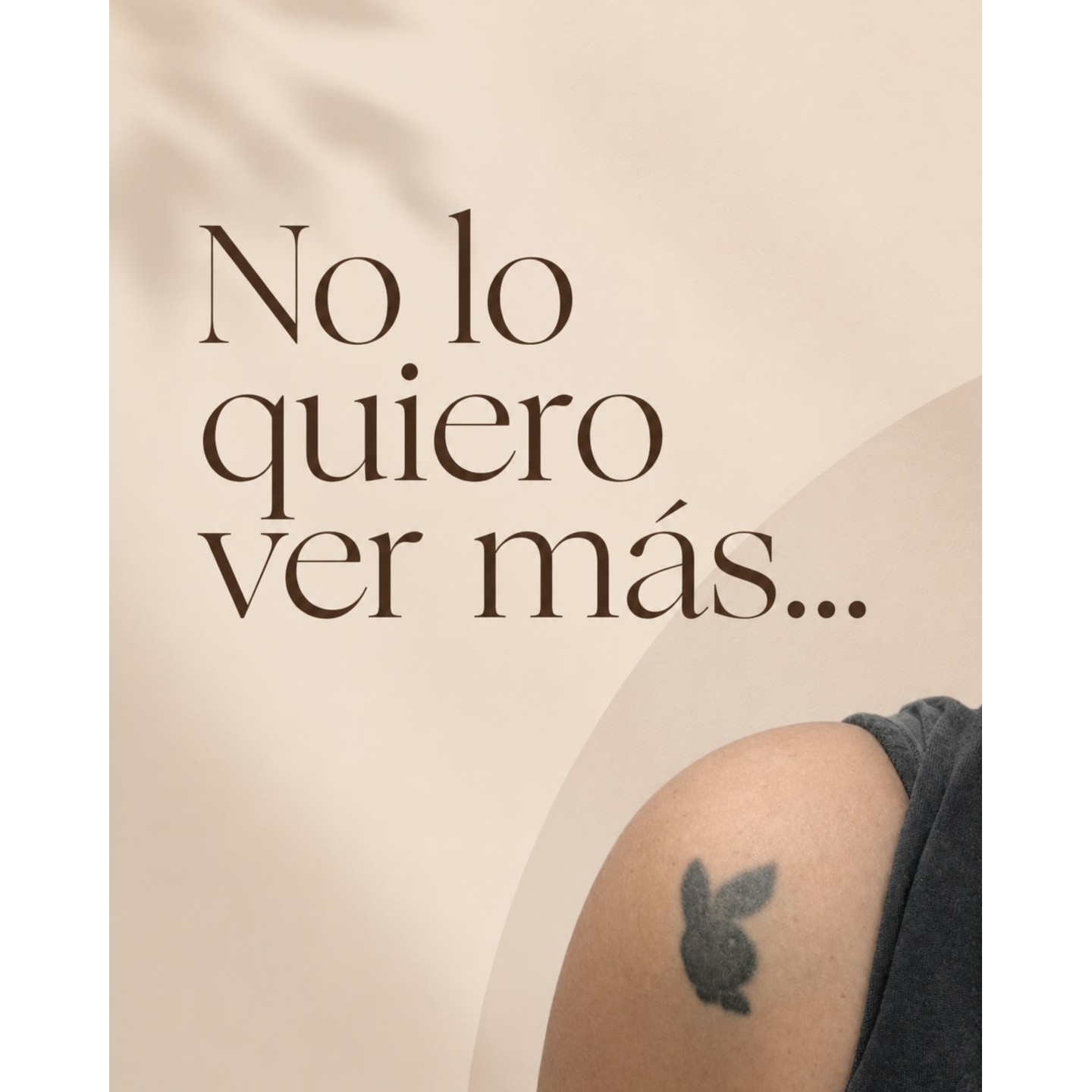 Remoción láser de tatuajes