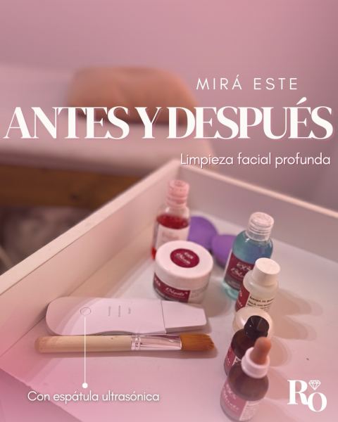 Limpieza facial profesional