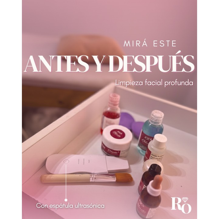 Limpieza facial profesional