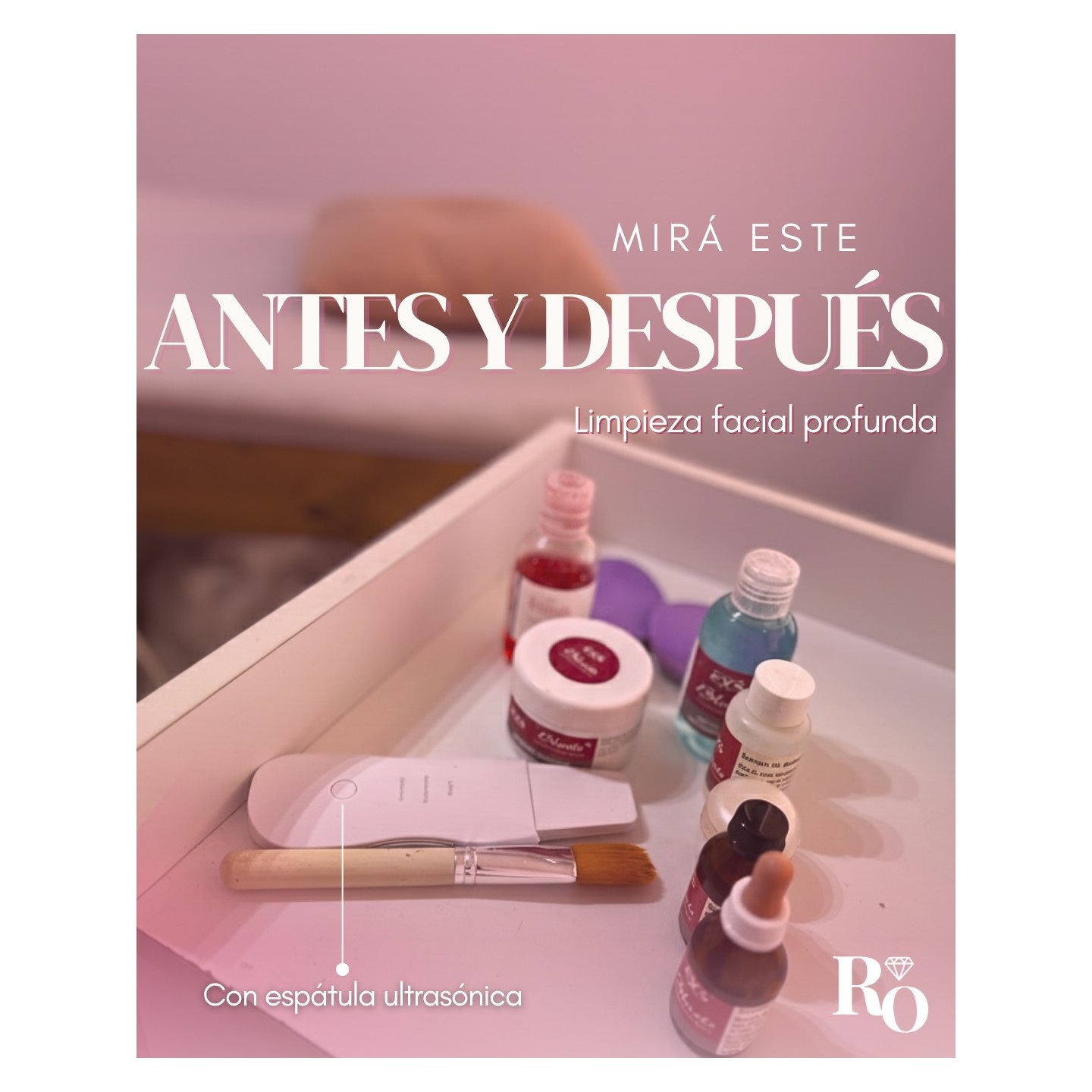 Limpieza facial profesional