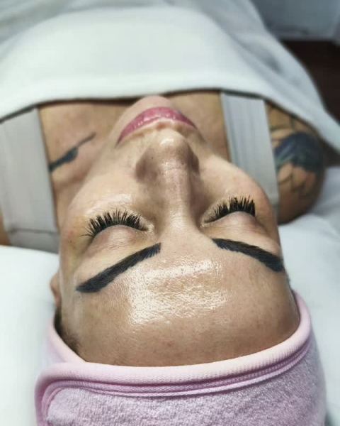 Evaluación y tratamiento facial personalizado