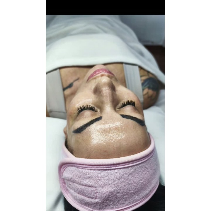 Evaluación y tratamiento facial personalizado