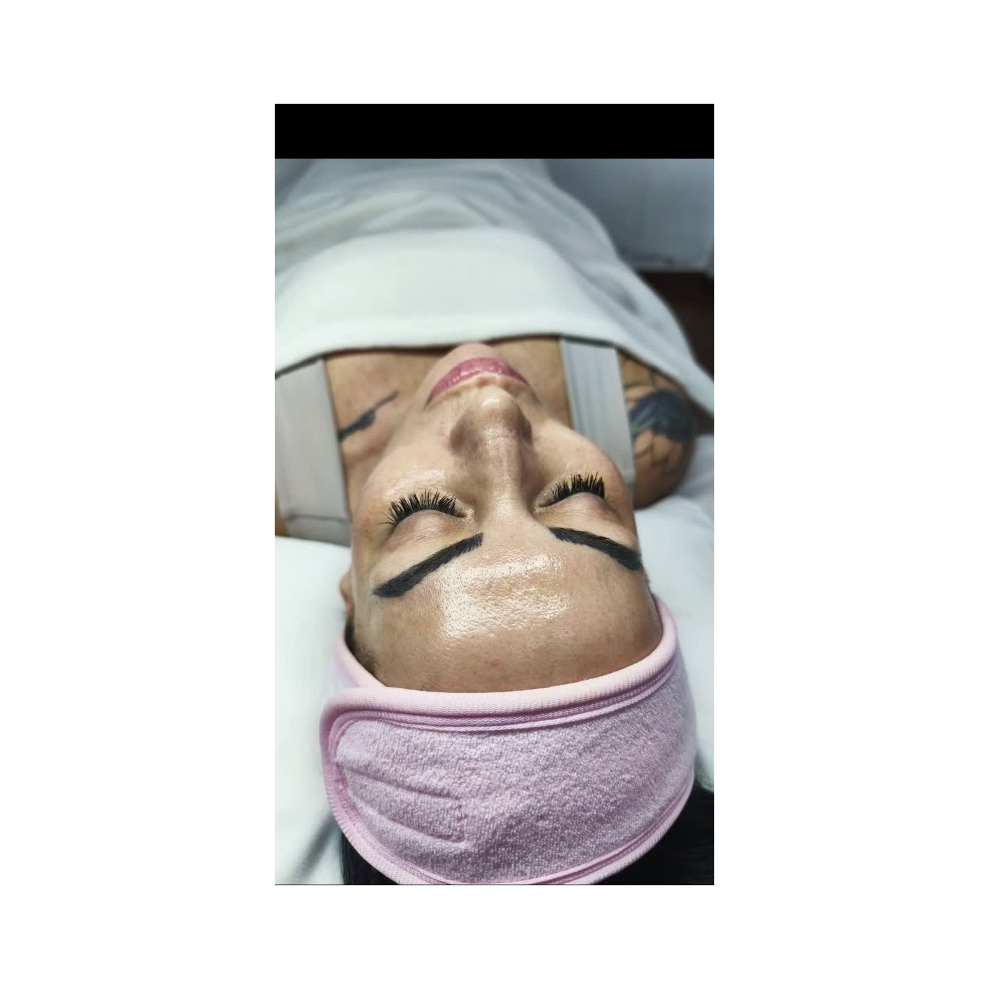 Evaluación y tratamiento facial personalizado