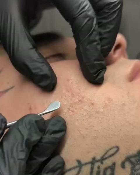 Higiene facial profunda