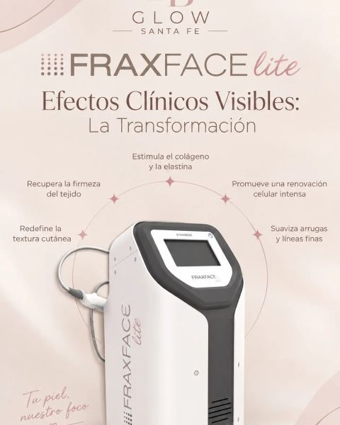 Radiofrecuencia fraccionada FraxFace