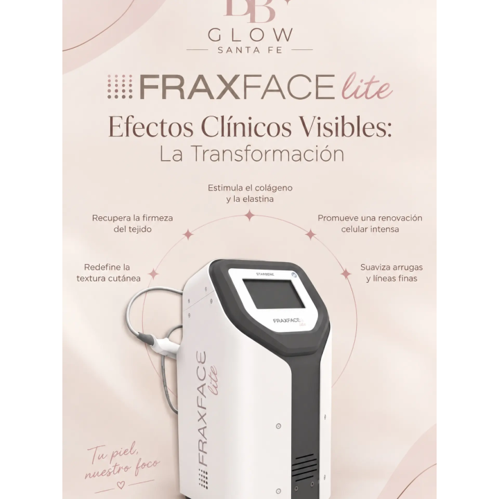 Radiofrecuencia fraccionada FraxFace