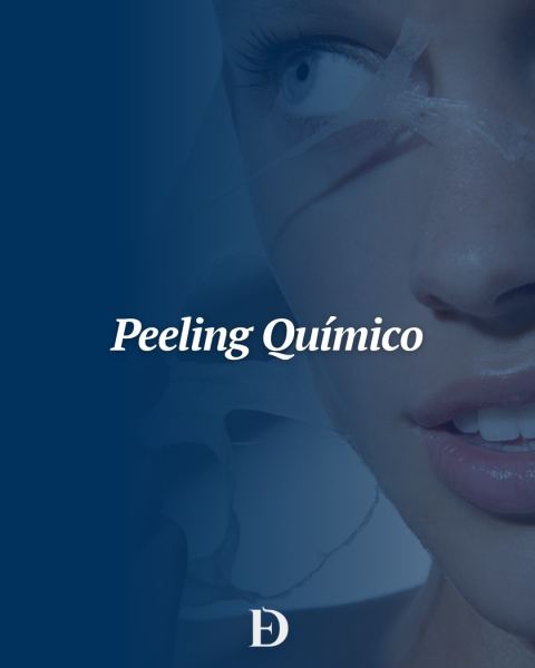 Peeling químico
