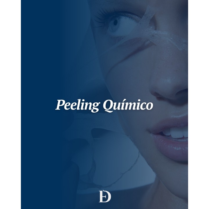 Peeling químico