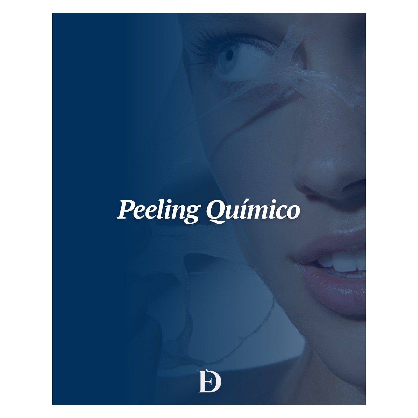 Peeling químico