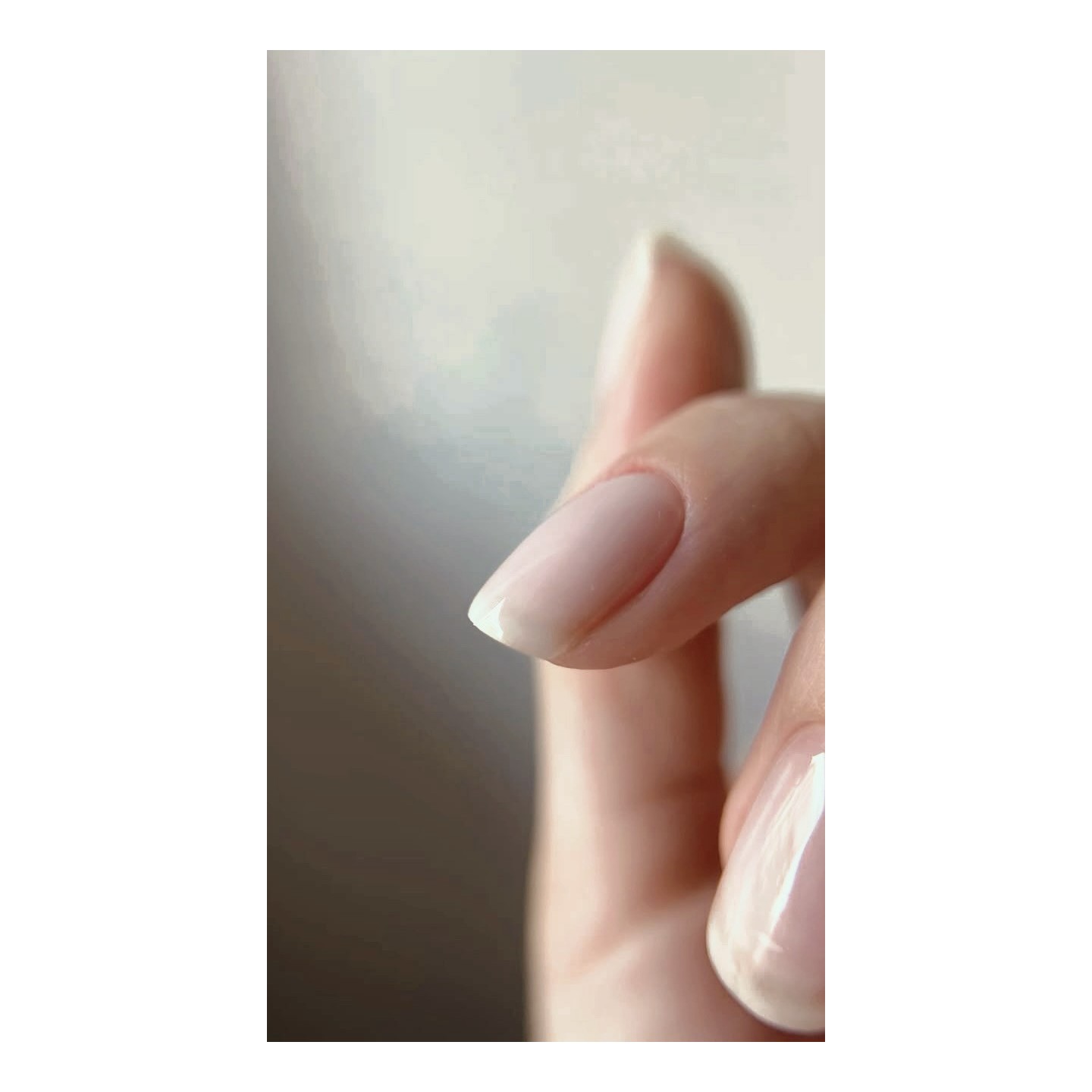 Nivelación de uñas