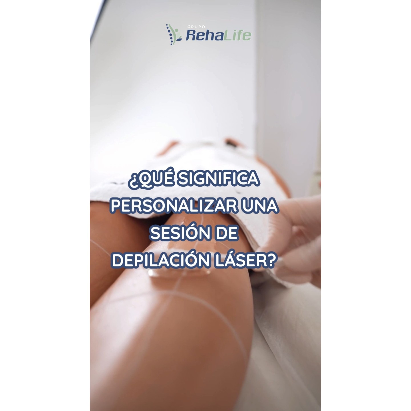 Depilación láser