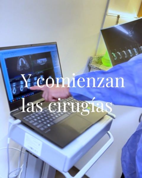 Implantes dentales