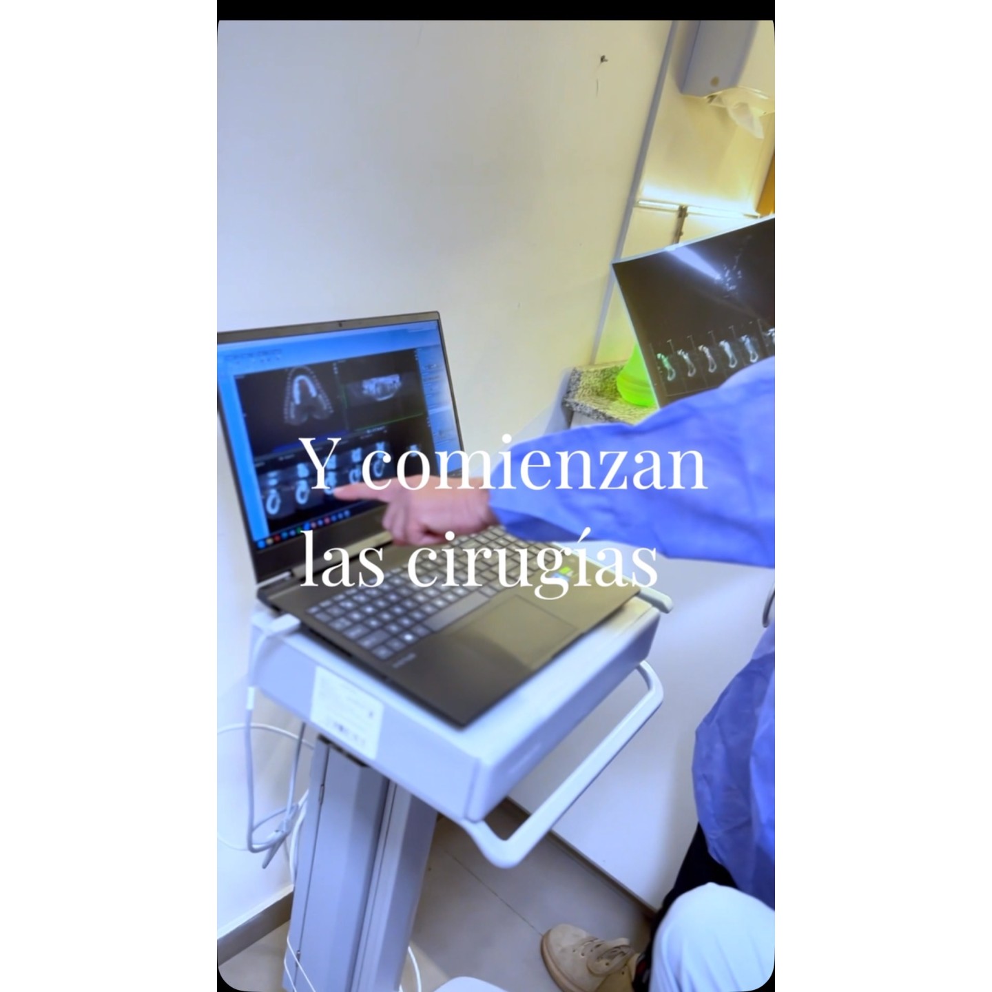 Implantes dentales