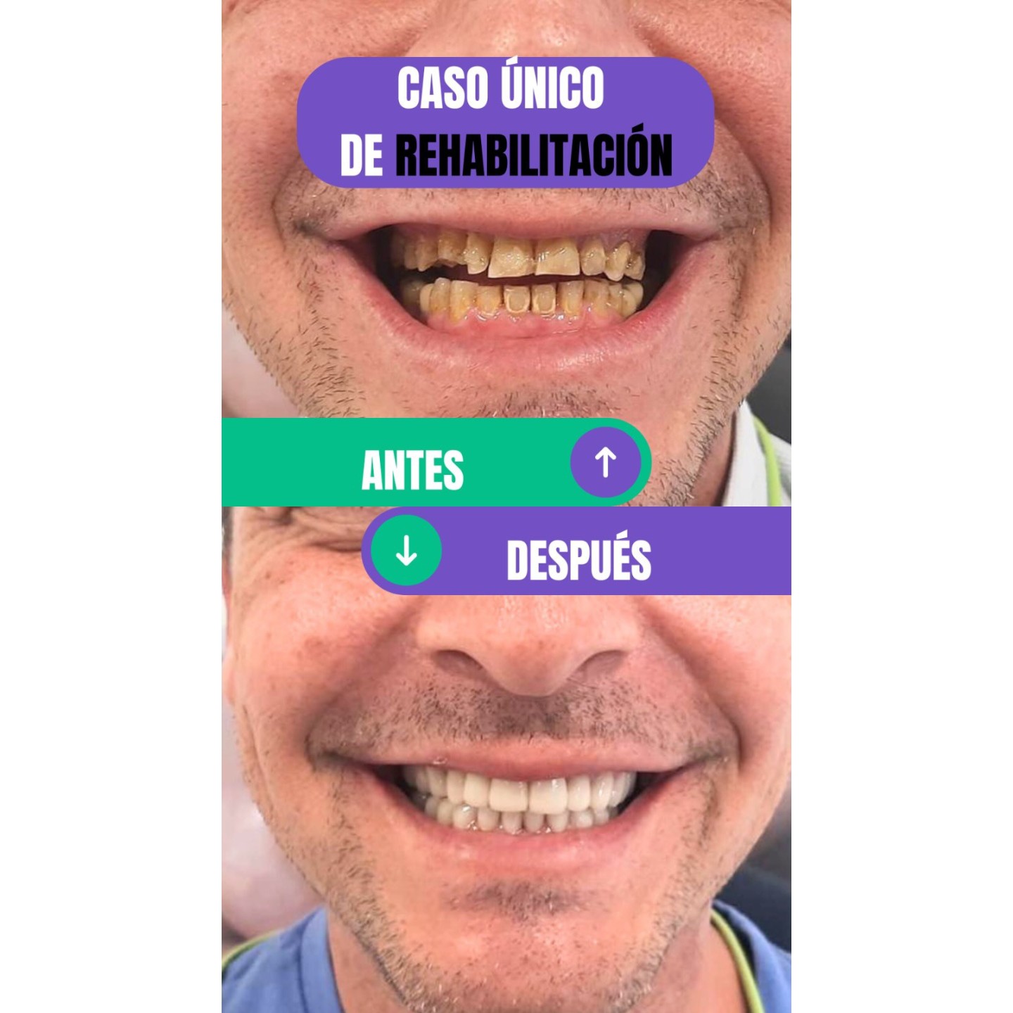 Rehabilitación oral