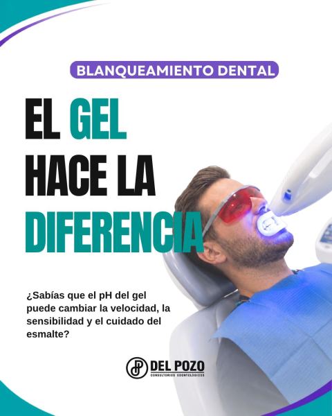 Blanqueamiento dental Beyond