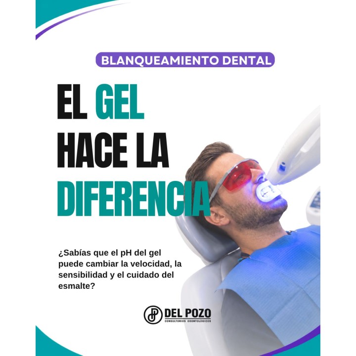 Blanqueamiento dental Beyond