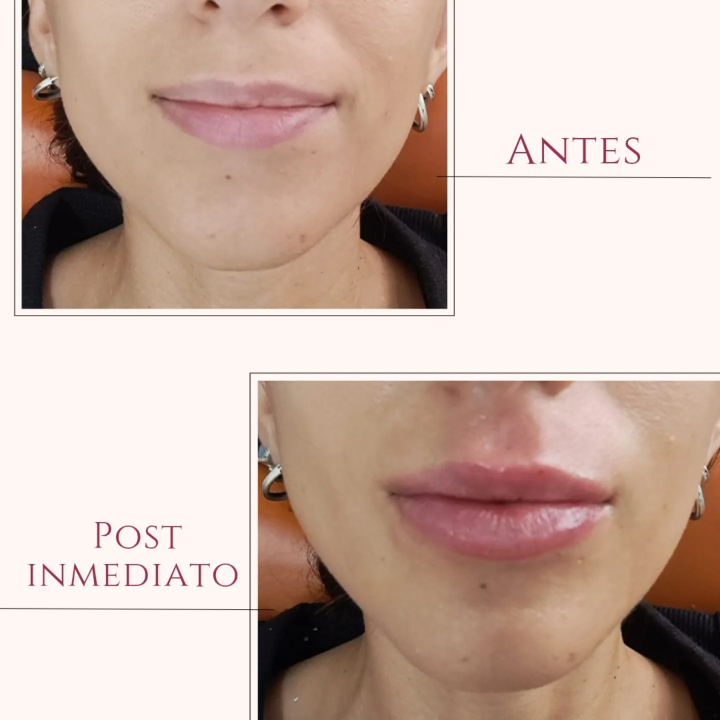 Armonización orofacial