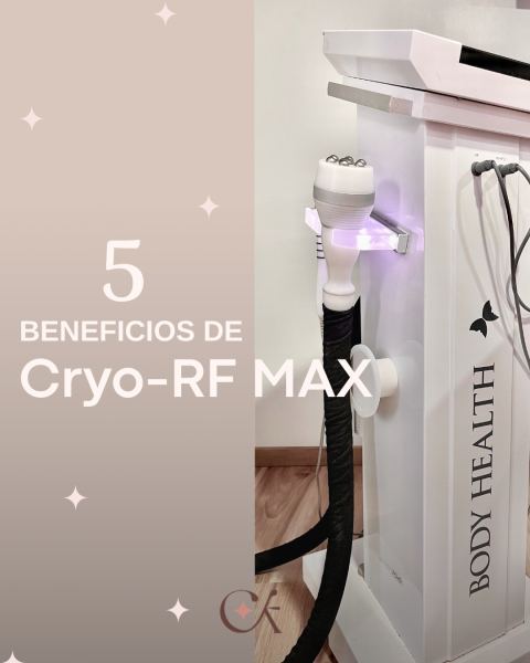 Criofrecuencia