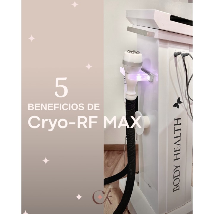 Criofrecuencia
