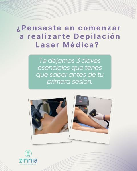 Depilación láser