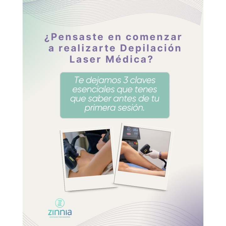 Depilación láser