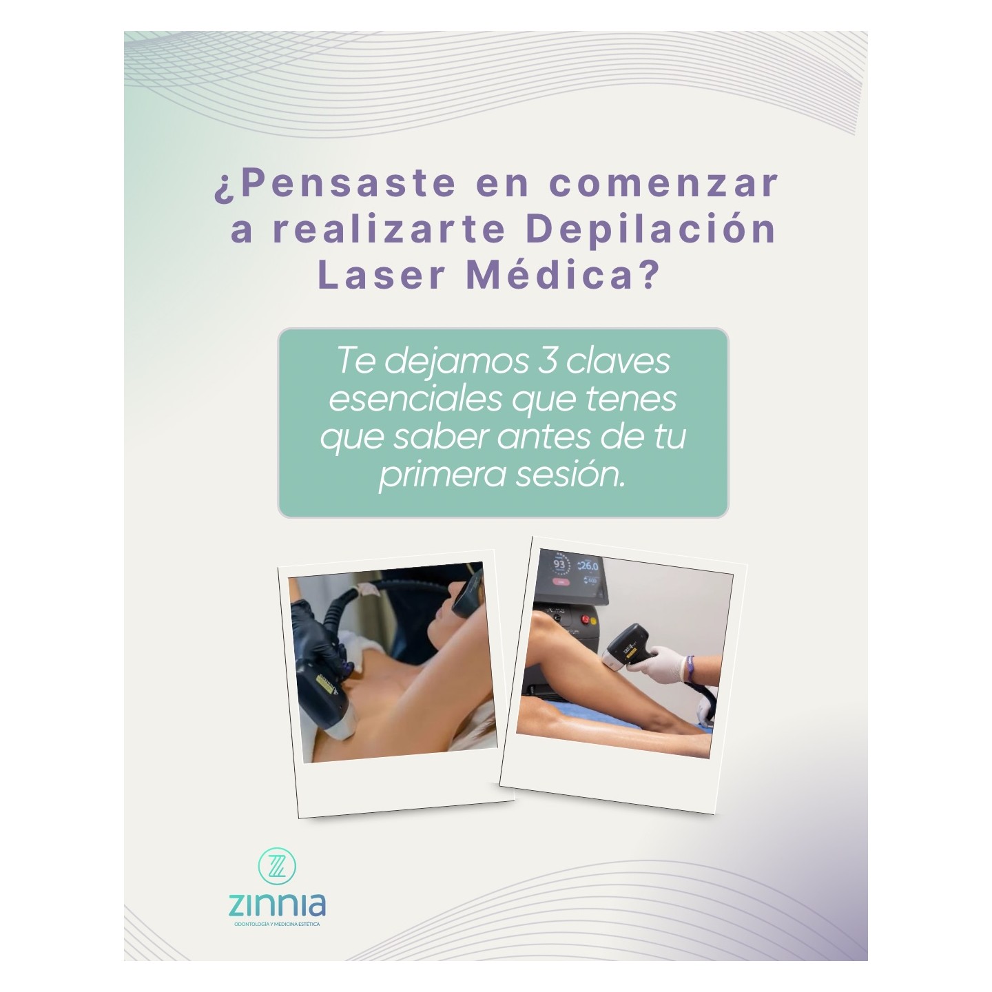 Depilación láser