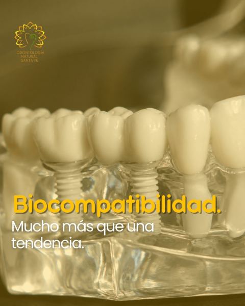 Implantes cerámicos
