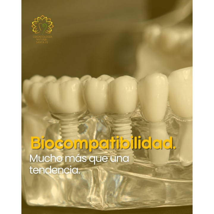Implantes cerámicos