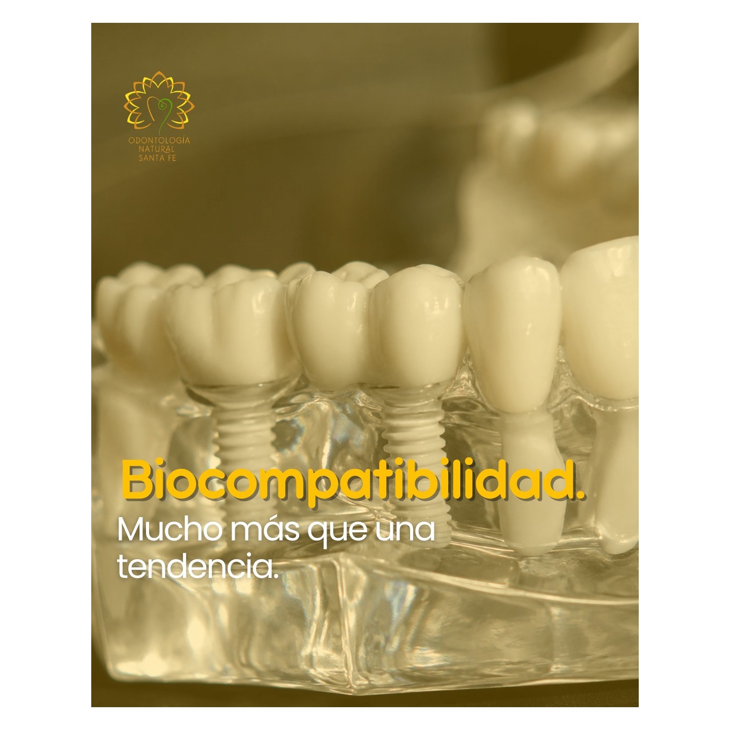 Implantes cerámicos