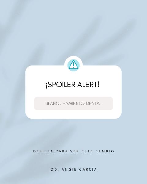 Blanqueamiento dental ambulatorio