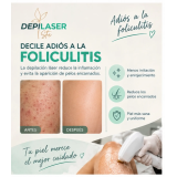 Tratamiento láser para la foliculitis
